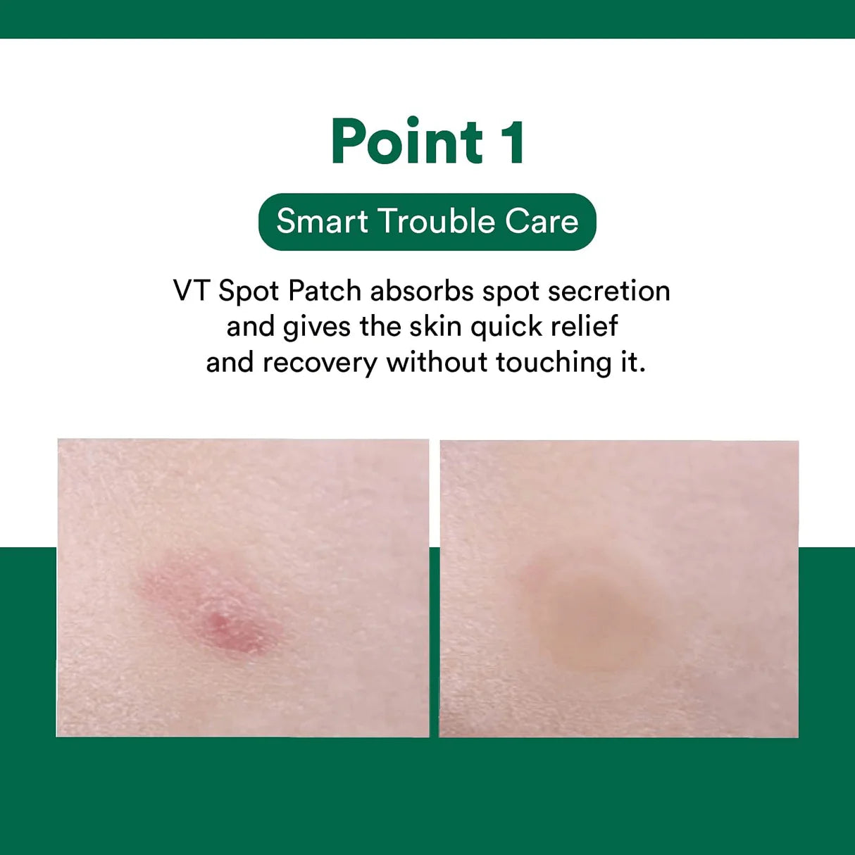 VT Spot Patch (3 Sets – 48 unidades) – VT Cosmetics